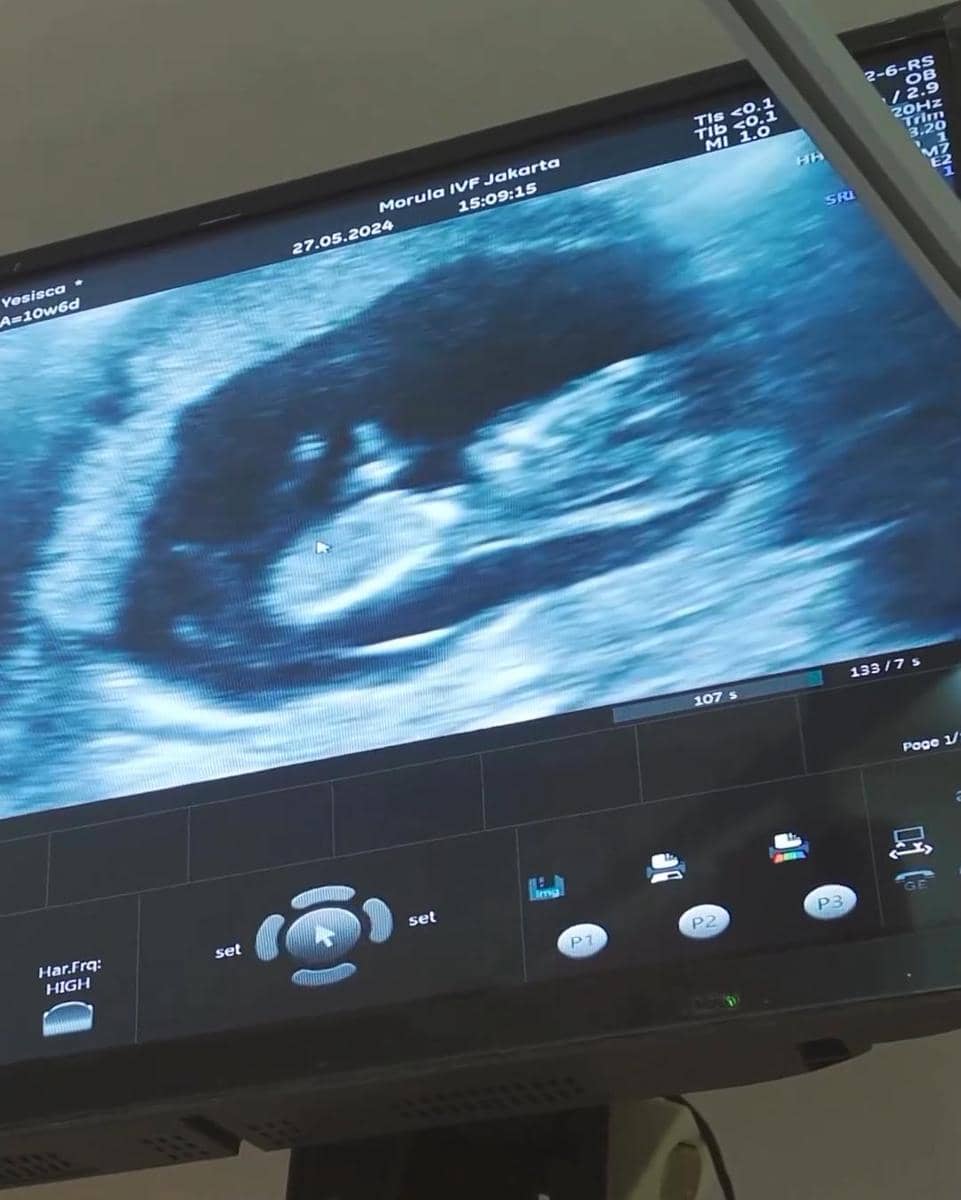 Instagram.com/inijedar